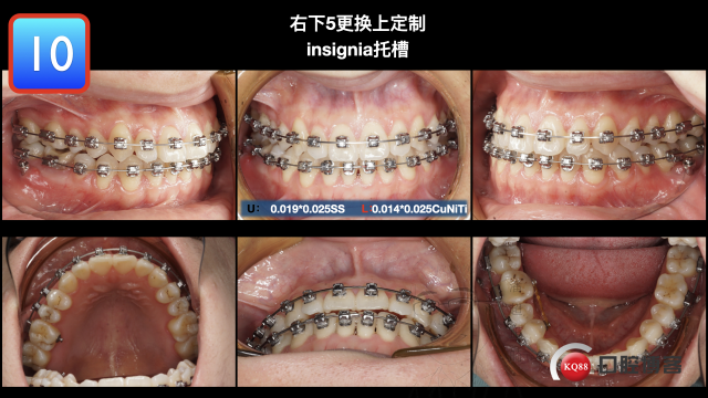 “insignia1号，涂雯丽”最终版 输出.037.jpeg