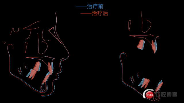 柳乂溪病例报告11.001.jpeg