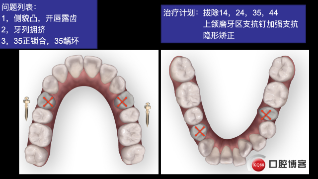 南昌潘超，倪婷妍投稿修改加20201104 摘录.008.jpeg