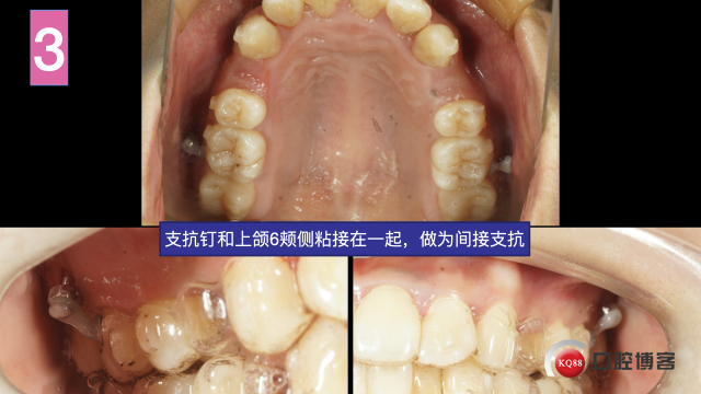 南昌潘超，倪婷妍投稿修改加20201104 摘录.011.jpeg