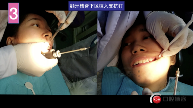 南昌潘超，倪婷妍投稿修改加20201104 摘录.012.jpeg