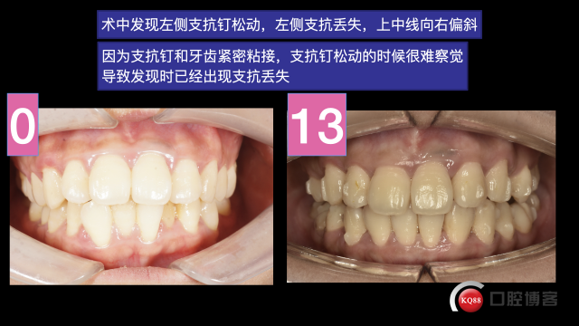 南昌潘超，倪婷妍投稿修改加20201104 摘录.018.jpeg