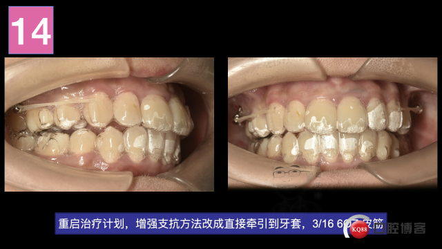 南昌潘超，倪婷妍投稿修改加20201104 摘录.020.jpeg
