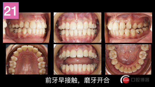 南昌潘超，倪婷妍投稿修改加20201104 摘录.023.jpeg