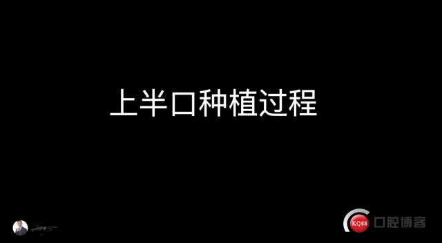 321608559498_.pic.jpg