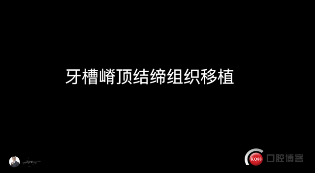 371608561966_.pic.jpg