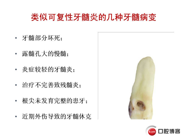 幻灯片11.JPG