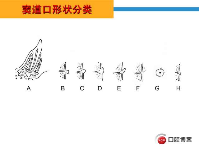 幻灯片26.JPG