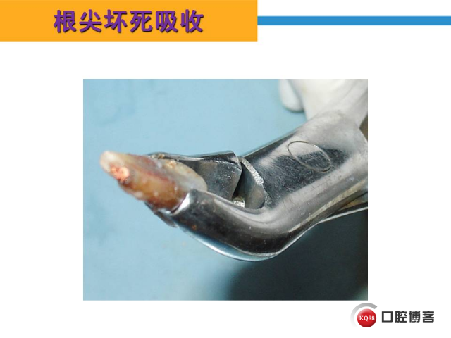 幻灯片31.JPG