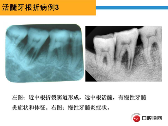 幻灯片39.JPG