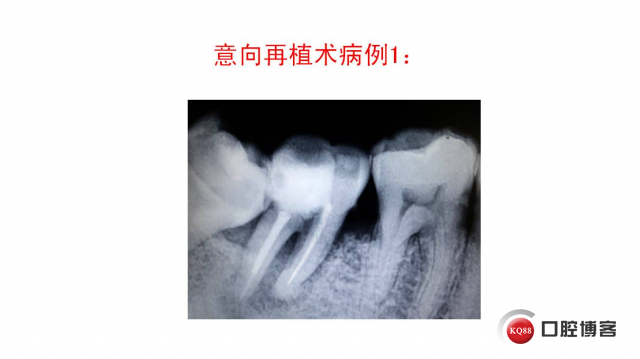 幻灯片35.JPG