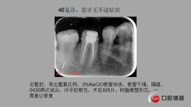 e2a8924c0991d48d8f47238e82ff20c.png