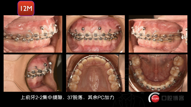 聂梦影最新图片输出.070.jpeg