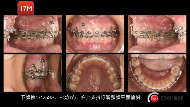 聂梦影最新图片输出.097.jpeg