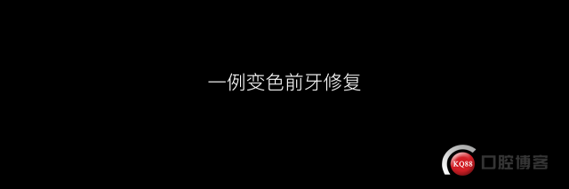 前牙变色修复.001.jpeg