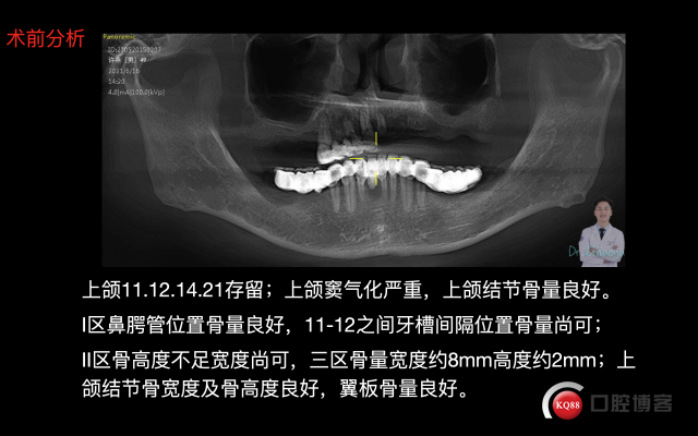 截屏2021-09-25 19.52.30.png