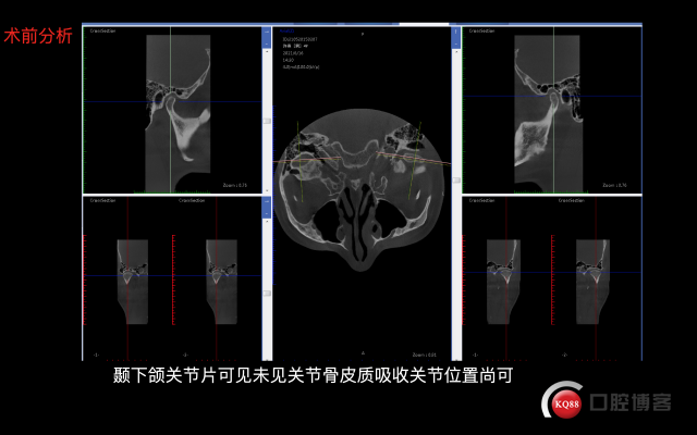 截屏2021-09-25 21.55.29.png