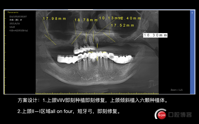 截屏2021-09-25 21.55.50.png