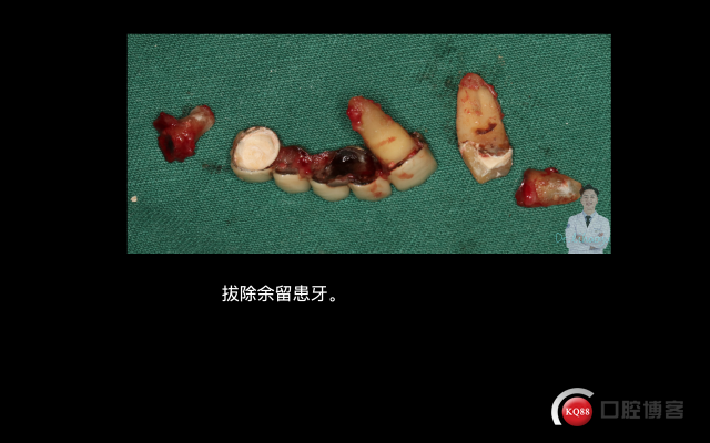 截屏2021-09-25 21.56.22.png