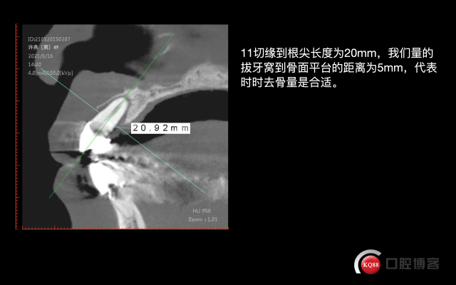 截屏2021-09-25 21.56.38.png