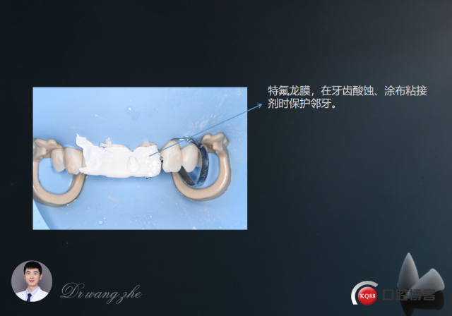 8591cb589b5b284714368906a947d82.png