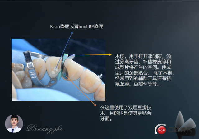 94ac6e8c3a33b52908b8ca7e022aa71.png