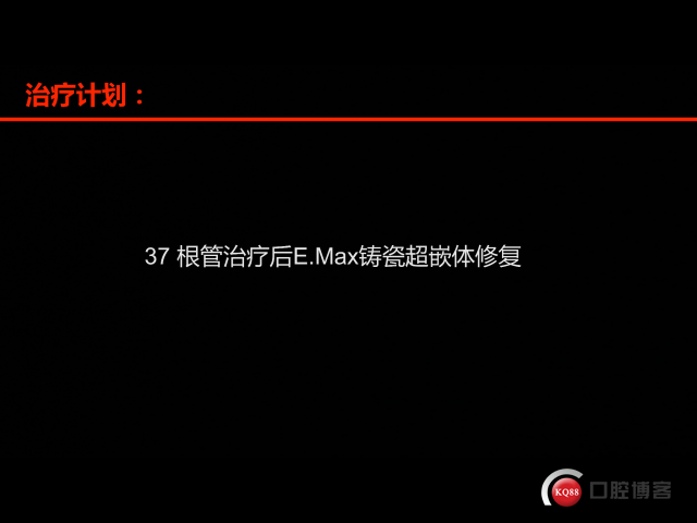 A3D4627E-5220-4FDB-BFD6-DCD0A6E4C78A.png