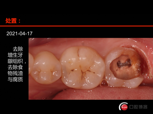 A09847DF-203B-495C-98FD-42D014E007EC.png