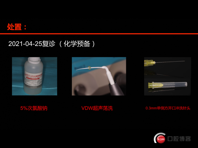 4A7F8F72-E8FE-4D77-8B0B-49D9380F41C7.png