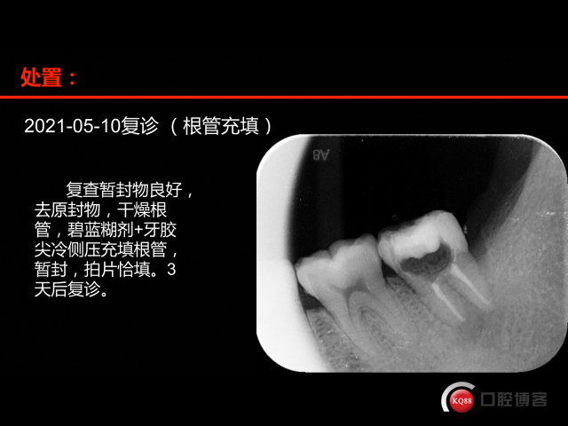 4A62A16F-279E-4363-9A60-9C3A363E1C65.png