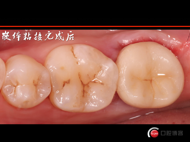 942633F6-3DCD-413E-BE16-3C6DD3AE52BC.png