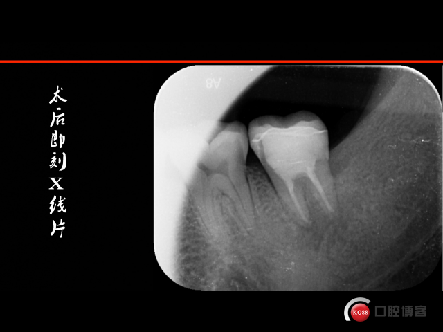 7F3C8413-F00E-4EEF-81BD-00D3514B31C3.png