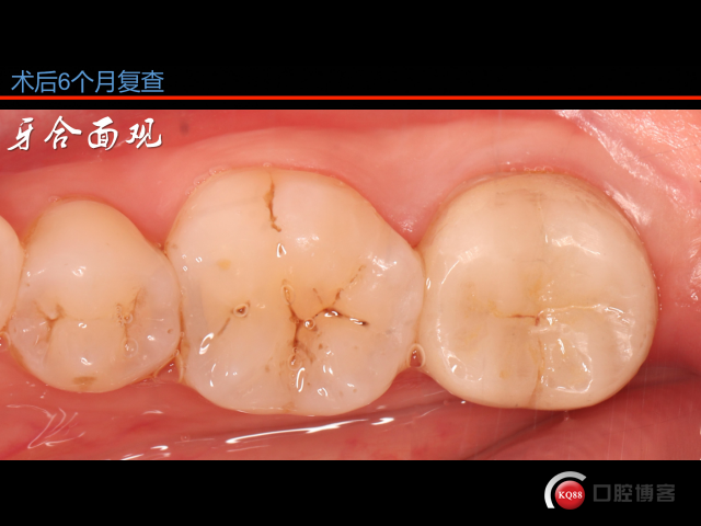 95AC300F-F511-4392-AB83-7018634001DE.png