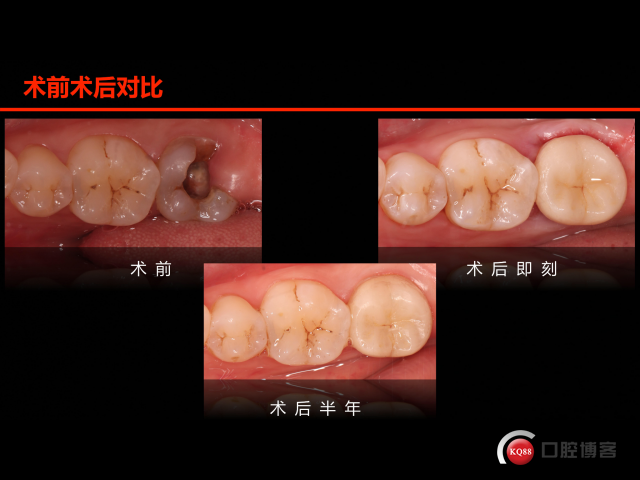 14BE4C5B-AA60-46B6-8A85-EA1165B09350.png