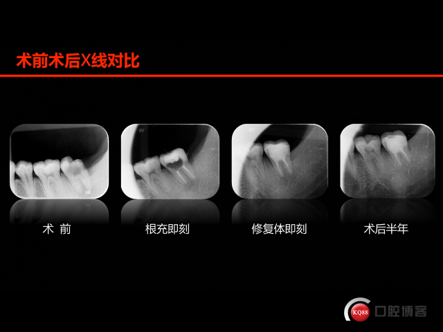 EDFFA58A-278E-4E42-8318-1A6B1A18E439.png