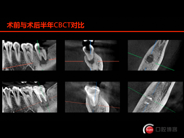 00FF0F8A-3354-4B9E-BBDC-5AA6F132CE7A.png