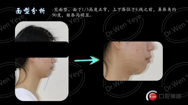 周zhihui的病例分享_04.jpg