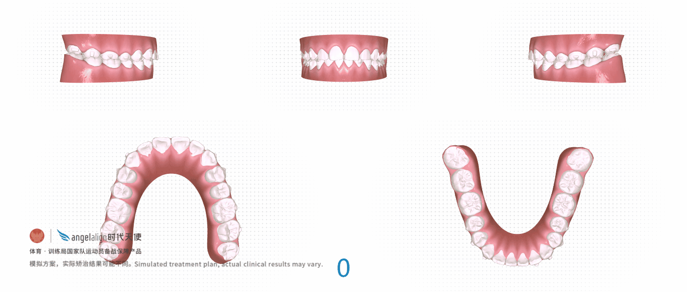 3D方案-周智慧.gif