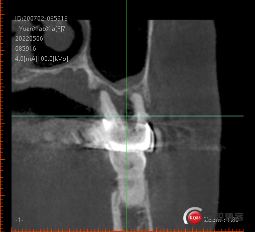 c465d5cad01b787bc514423c211622a.png