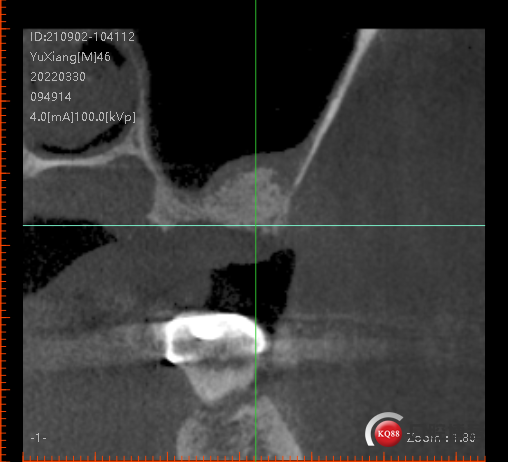 afa3142f9e15346a6c6fb2d3e311de5.png