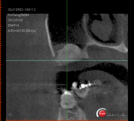 e14e56328dada738994809f43ec56ee.png