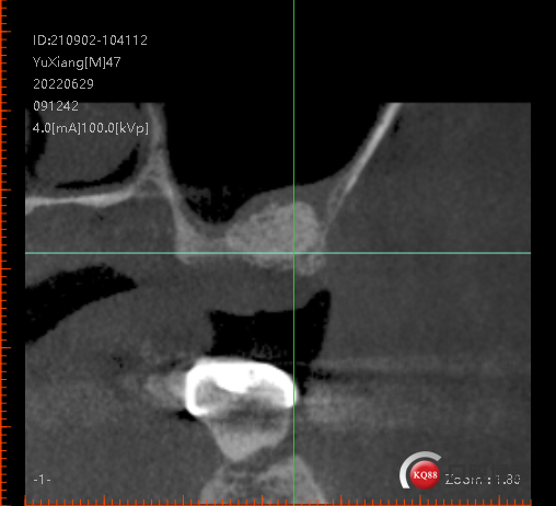 dcc641eacc49cce22375494a8e8c601.png