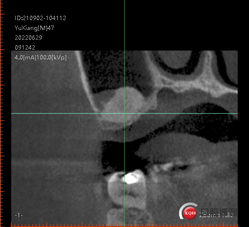 9702d0ae5cb6f05acb678fa29a53806.png