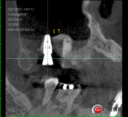 105d968f8f4b4cc2f537521a0f28de4.png