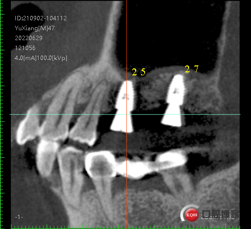 3d285a85ee1b6fc1205cbab97f6bf87.png
