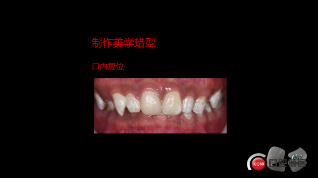 9fa8f1b22c557476712e2d2e4a80187.png