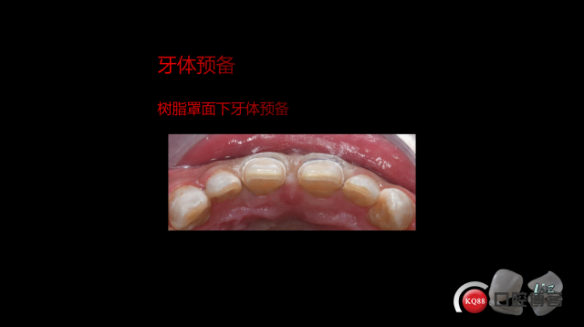 47a1d45423a1c1d74f9df0253dc6005.png