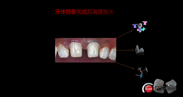 a716ff18d17163add7a676d8daae39a.png