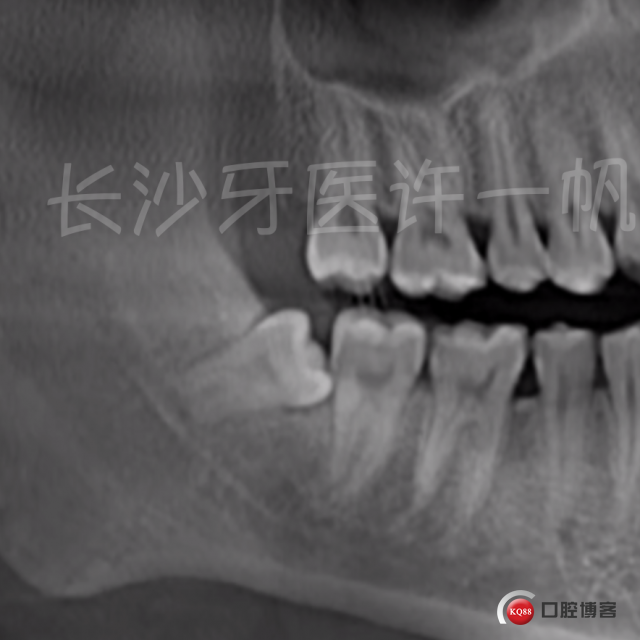 截屏2023-03-08 15.39.58.png
