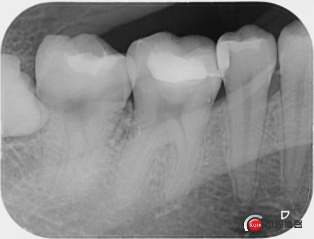 1681983990_871195.jpg 叶文娅_蓝_灯箱(1)_X-ray_20230411_181559.jpg